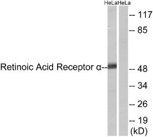 Western blot analysis of lysates from HeLa cells using Anti-Retinoic Acid Receptor alpha Antibody. The right hand lane represents a negative control, where the antibody is blocked by the immunising peptide