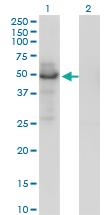 Anti-PLTP Mouse Monoclonal Antibody [clone: 2F3-G4]