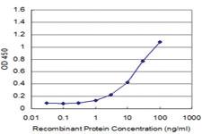 Anti-ANOS1 Mouse Monoclonal Antibody [clone: 2E8]