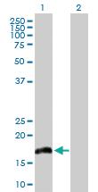 Anti-IL20 Rabbit Polyclonal Antibody