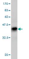 Anti-RNF6 Mouse Monoclonal Antibody [clone: 3B1]