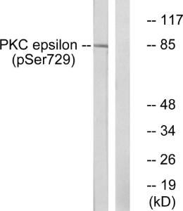 Western blot analysis of lysates from HeLa cells treated with PMA 125ng/ml 30' using Anti-PKC epsilon (phospho Ser729) Antibody. The right hand lane represents a negative control, where the antibody is blocked by the immunising peptide.