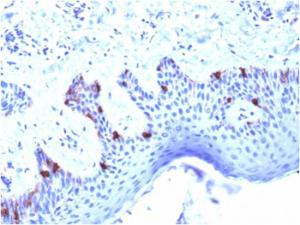 Immunohistochemical analysis of formalin-fixed, paraffin-embedded human skin using Anti-Melanoma gp100 Antibody [PMEL/2039]