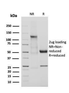 SDS-PAGE analysis of Anti-Adiponectin Antibody [ADPN/4255] under non-reduced and reduced conditions; showing intact IgG and intact heavy and light chains, respectively. SDS-PAGE analysis confirms the integrity and purity of the antibody