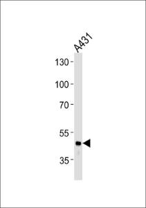 Anti-FGG Rabbit Polyclonal Antibody