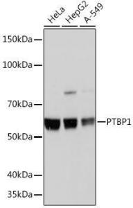 Western blot analysis of extracts of various cell lines, using Anti-PTBP1 Antibody [ARC0783] (A307129) at 1:1,000 dilution. The secondary antibody was Goat Anti-Rabbit IgG H&L Antibody (HRP) at 1:10,000 dilution.