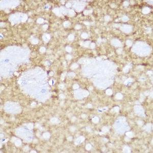 Immunohistochemistry analysis of paraffin-embedded mouse brain using Anti-TrkA +TRkB + TrkC Antibody [ARC2649] (A309687) at a dilution of 1:100 (40x lens). Perform high pressure antigen retrieval with 10 mM citrate buffer pH 6.0 before commencing with IHC staining protocol.