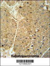 Anti-ADH1C Rabbit Polyclonal Antibody