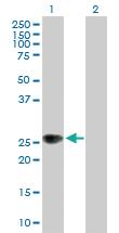 Anti-ZNRF1 Mouse Polyclonal Antibody