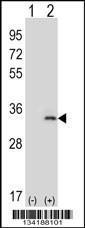 Anti-IL33 Rabbit Polyclonal Antibody (HRP (Horseradish Peroxidase))