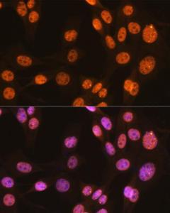 Immunofluorescence analysis of NIH-3T3 cells using Anti-PTBP1 Antibody [ARC0783] (A307129) at a dilution of 1:100 (40x lens). DAPI was used to stain the cell nuclei (blue).