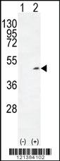 Anti-ADH1C Rabbit Polyclonal Antibody