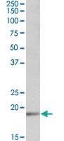 Anti-UBE2C Goat Polyclonal Antibody