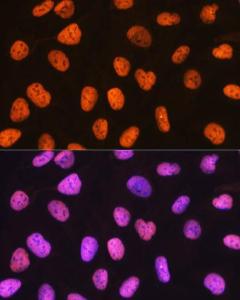 Immunofluorescence analysis of U-2 OS cells using Anti-PTBP1 Antibody [ARC0783] (A307129) at a dilution of 1:100 (40x lens). DAPI was used to stain the cell nuclei (blue).