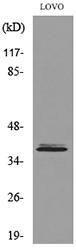 Western blot analysis of lysate from LOVO cells using Anti-KLF1 Antibody