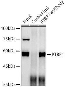 Immunoprecipitation analysis of 300µg extracts of HepG2 cells using 3µg of Anti-PTBP1 Antibody [ARC0783] (A307129). This Western blot was performed on the immunoprecipitate using Anti-PTBP1 Antibody [ARC0783] (A307129) at a dilution of 1:1000.