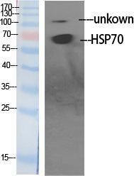 Anti-HS71L antibody