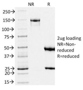 SDS-PAGE analysis of Anti-Melanoma gp100 Antibody [PMEL/2039] under non-reduced and reduced conditions; showing intact IgG and intact heavy and light chains, respectively. SDS-PAGE analysis confirms the integrity and purity of the antibody