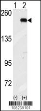 Anti-EIF2AK4 Rabbit Polyclonal Antibody