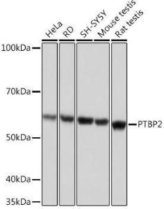 Anti-PTBP2 Rabbit Monoclonal Antibody [clone: ARC1798]