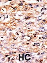 Anti-EIF2AK4 Rabbit Polyclonal Antibody