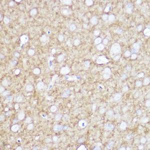 Immunohistochemistry analysis of paraffin-embedded rat brain using Anti-TrkA +TRkB + TrkC Antibody [ARC2649] (A309687) at a dilution of 1:100 (40x lens). Perform high pressure antigen retrieval with 10 mM citrate buffer pH 6.0 before commencing with IHC staining protocol.