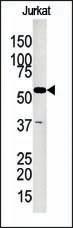 Anti-GK2 Rabbit Polyclonal Antibody