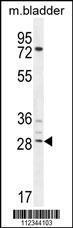 Anti-AKIP1 Rabbit Polyclonal Antibody