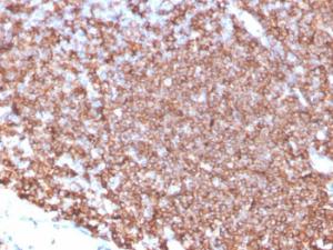 Immunohistochemical analysis of formalin-fixed, paraffin-embedded human tonsil tissue using Anti-CD20 Antibody [MS4A1/4655]