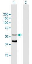 Anti-CYP4F12 Mouse Polyclonal Antibody