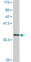 Anti-TBR1 Mouse Polyclonal Antibody