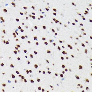 Anti-PTBP2 Rabbit Monoclonal Antibody [clone: ARC1798]