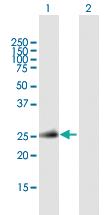 Anti-TNFSF11 Mouse Polyclonal Antibody