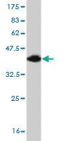 Anti-TBR1 Mouse Monoclonal Antibody [clone: 3F6]