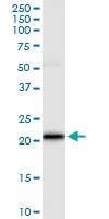 Anti-VSTM2L Polyclonal Antibody Pair