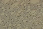 Anti-DNMT1 Mouse Monoclonal Antibody [clone: 60B1220.1]