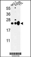 Anti-Heterochromatin Protein p25 Rabbit Polyclonal Antibody (HRP (Horseradish Peroxidase))