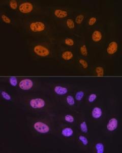 Anti-PTBP2 Rabbit Monoclonal Antibody [clone: ARC1798]