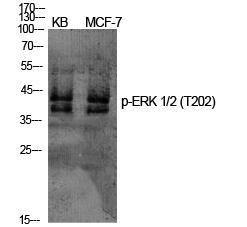 Western blot analysis of various cells using Anti-ERK1 + ERK2 (phospho Thr202) Antibody