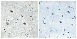 Anti-HS71L antibody