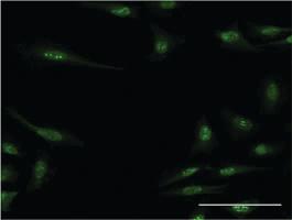 Anti-RBM15 Mouse Monoclonal Antibody [clone: 3E2]