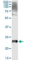 Anti-VSTM2L Antibody Pair