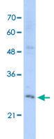 Anti-EXOSC4 Rabbit Polyclonal Antibody