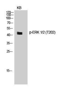 Western blot analysis of KB cells using Anti-ERK1 + ERK2 (phospho Thr202) Antibody