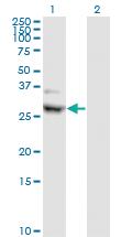 Anti-CIDEA Mouse Monoclonal Antibody [clone: 4B9]