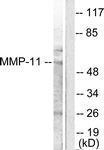 Anti-MMP11 Rabbit Polyclonal Antibody