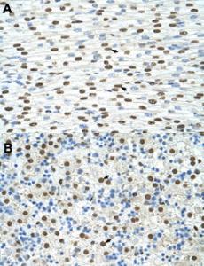 Anti-EXOSC4 Rabbit Polyclonal Antibody