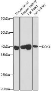 Western blot analysis of extracts of various cell lines, using Anti-DOK4 Antibody (A12554) at 1:1,000 dilution