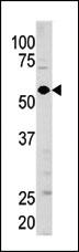 Anti-Guanylyl Cyclase alpha 1 (GUCY1A3) Rabbit Polyclonal Antibody