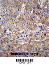 Anti-DIEXF Rabbit Polyclonal Antibody